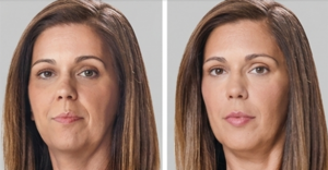 , Services – Wrinkle Reducers